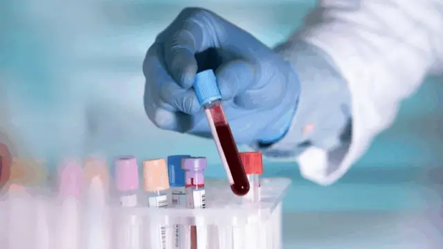 Lab technician handling blood test tubes for comprehensive thyroid and hormone panel testing